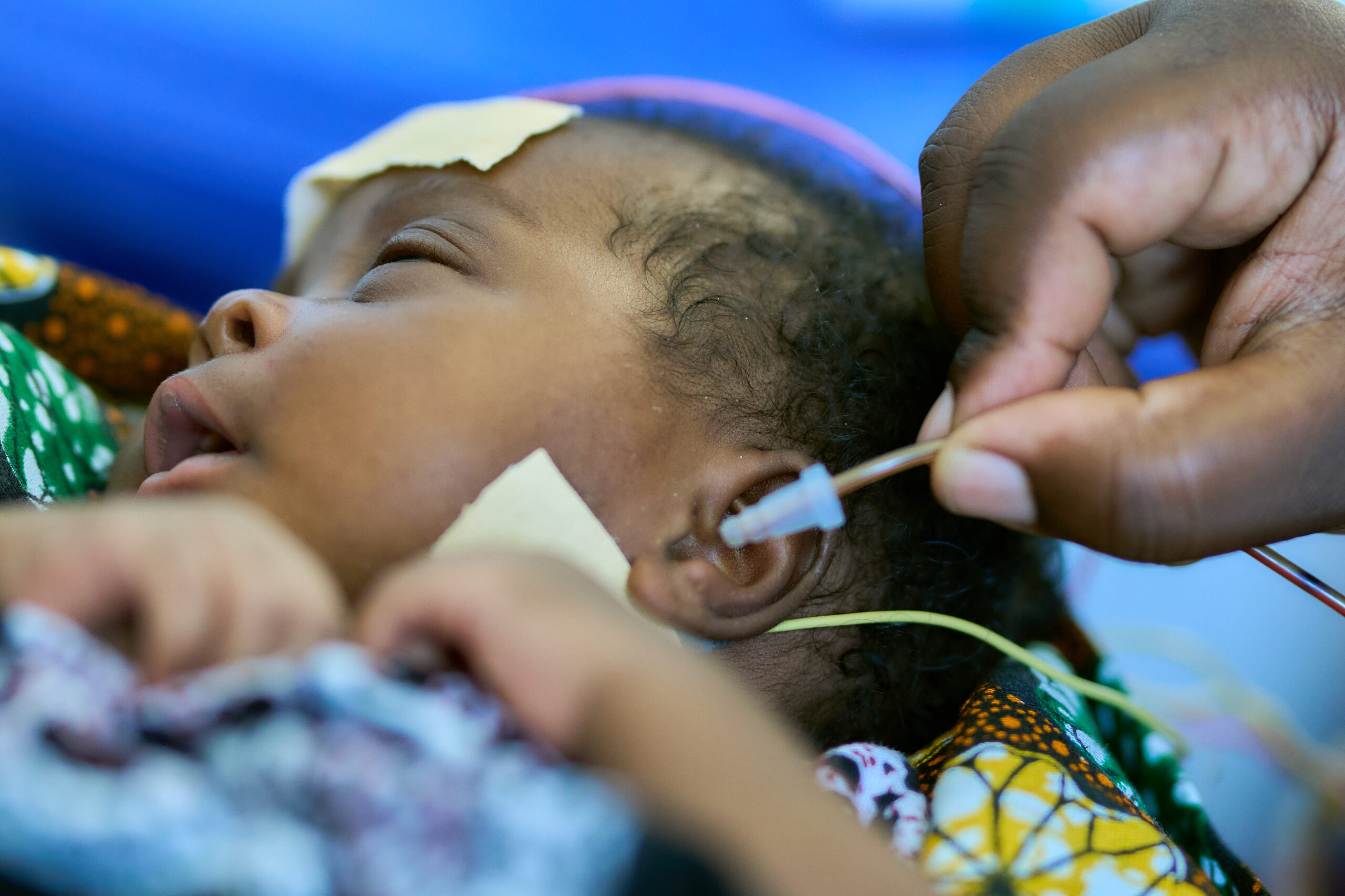 A close up of very young Tanzanian baby who is having a hearing probe inserted into her ear